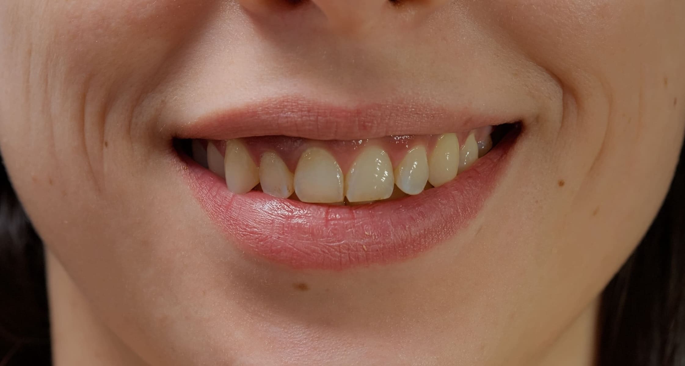 Before-Img